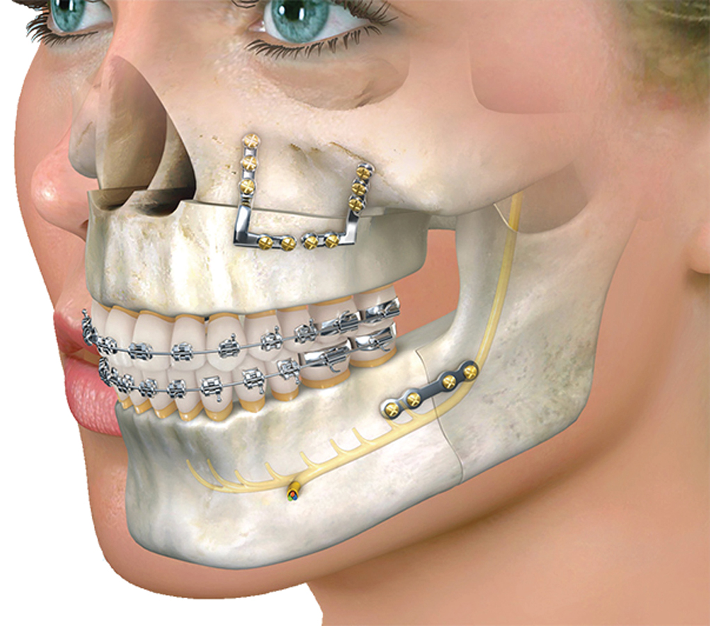 Oral and Maxillofacial Surgery